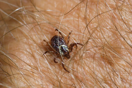 All About Ticks and Tick Removal Image